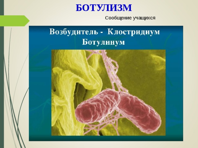 Возбудитель ботулизма. Возбудитель ботулизма бактерия клостридиум ботулинум. Клостридии возбудители ботулизма. Ботулизм бактерия возбудитель. Clostridium botulinum возбудитель ботулизма.