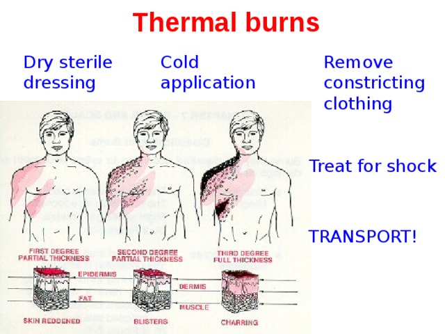 Thermal burns Cold application Remove constricting clothing Dry sterile dressing  Treat for shock TRANSPORT! 