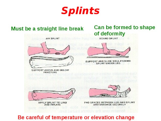Splints Can be formed to shape of deformity Must be a straight line break Be careful of temperature or elevation change 