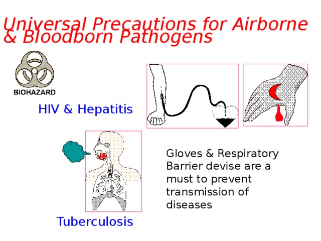 Universal Precautions for Airborne  & Bloodborn Pathogens HIV & Hepatitis Gloves & Respiratory Barrier devise are a must to prevent transmission of diseases Tuberculosis  