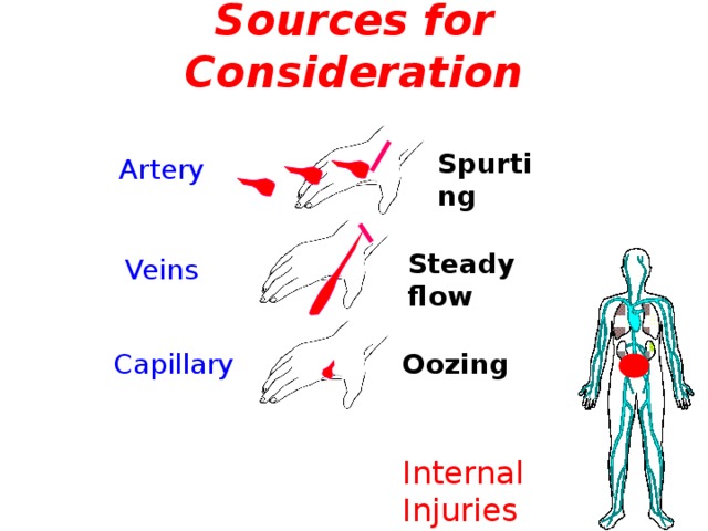 Sources for Consideration Spurting Artery Steady flow Veins Oozing Capillary Internal Injuries  