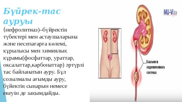 Презентация несеп тас ауруы