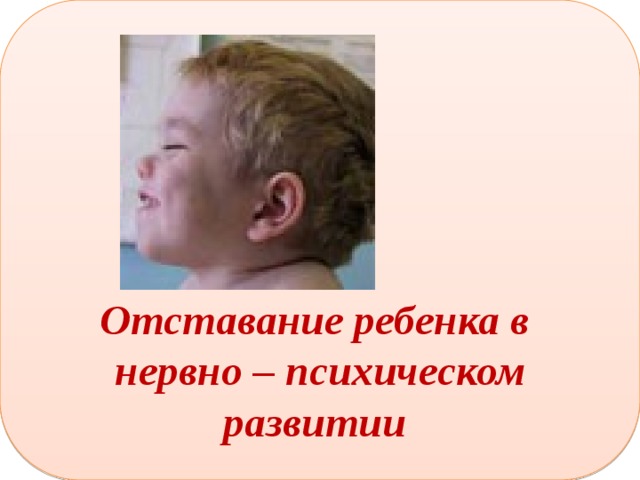      Отставание ребенка в нервно – психическом развитии 