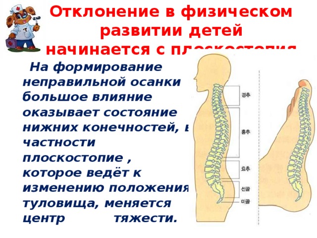 Что называется осанкой