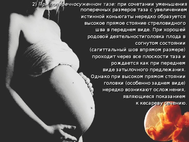  2) При поперечносуженном тазе: при сочетании уменьшения поперечных размеров таза с увеличением  истинной коньюгаты нередко образуется  высокое прямое стояние стреловидного шва в переднем виде. При хорошей родовой деятельностиголовка плода в согнутом состоянии (сагиттальный шов впрямом размере) проходит через все плоскости таза и рождается как при переднем виде затылочного предлежания. Однако при высоком прямом стоянии головки (особенно заднем виде) нередко возникают осложнения, являющиеся показанием к кесареву сечению. 