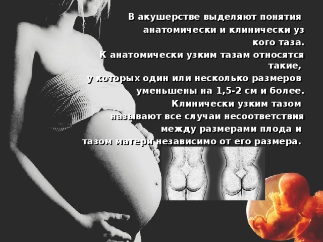 В акушерстве выделяют понятия анатомически и клинически уз кого таза.  К анатомически узким тазам относятся такие, у которых один или несколько размеров уменьшены на 1,5-2 см и более.  Клинически узким тазом называют все случаи несоответствия  между размерами плода и тазом матери независимо от его размера. 