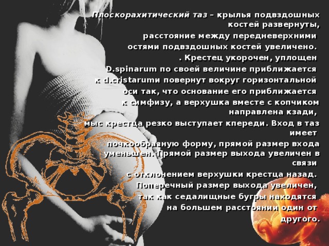 Плоскорахитический таз – крылья подвздошных костей развернуты,  расстояние между передневерхними остями подвздошных костей увеличено. . Крестец укорочен, уплощен D.spinarum по своей величине приближается к d.cristarumи повернут вокруг горизонтальной оси так, что основание его приближается к симфизу, а верхушка вместе с копчиком направлена кзади, мыс крестца резко выступает кпереди. Вход в таз имеет почкообразную форму, прямой размер входа уменьшен. Прямой размер выхода увеличен в связи с отклонением верхушки крестца назад. Поперечный размер выхода увеличен, так как седалищные бугры находятся на большем расстоянии один от другого. 