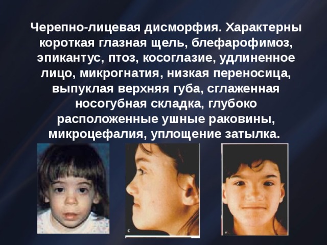 Табачный синдром плода презентация