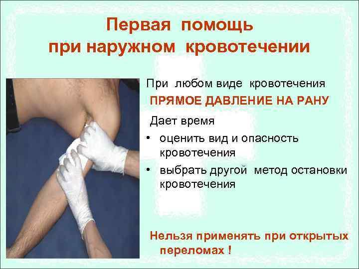Оказание первой доврачебной помощи при кровотечении презентация