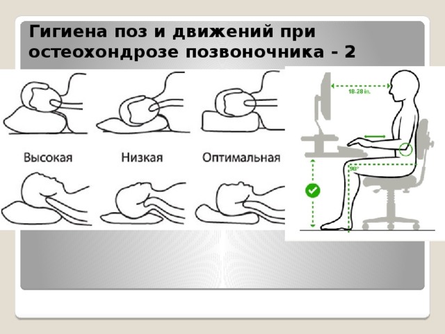 Гигиена поз и движений при остеохондрозе позвоночника - 2 