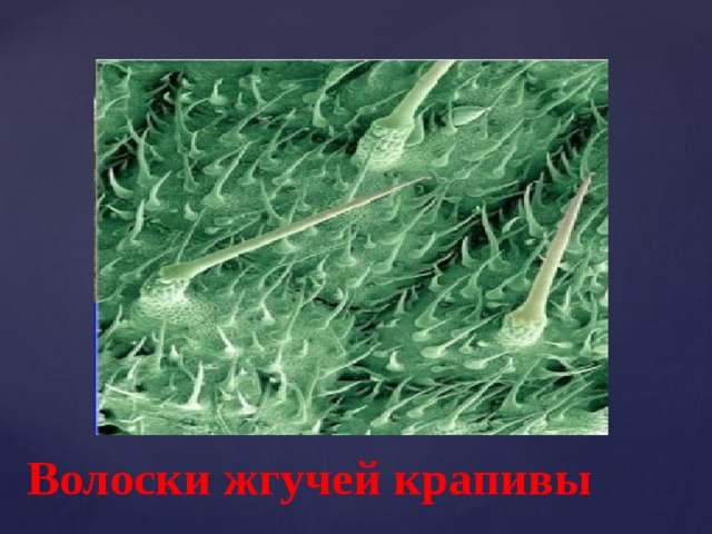 Строение волоска крапивы. Трихомы крапивы под микроскопом. Волоски крапивы под микроскопом. Клетка крапивы под микроскопом. Крапива в микроскопе.