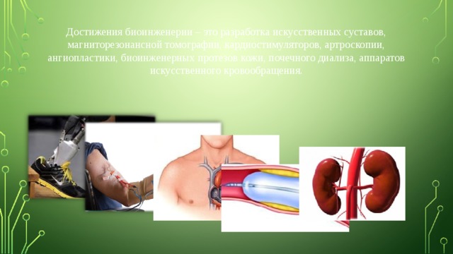 Достижения биоинженерии – это разработка искусственных суставов, магниторезонансной томографии, кардиостимуляторов, артроскопии, ангиопластики, биоинженерных протезов кожи, почечного диализа, аппаратов искусственного кровообращения. 