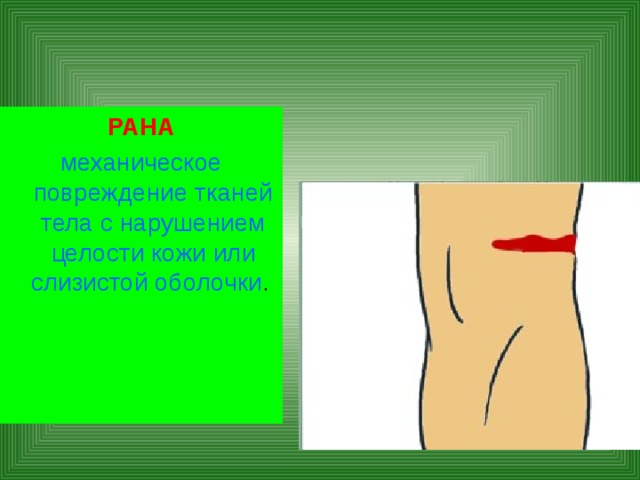 РАНА механическое повреждение тканей тела с нарушением целости кожи или слизистой оболочки . 