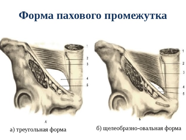 Схема топографии пахового канала