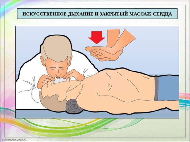 Презентация искусственное дыхание и массаж сердца