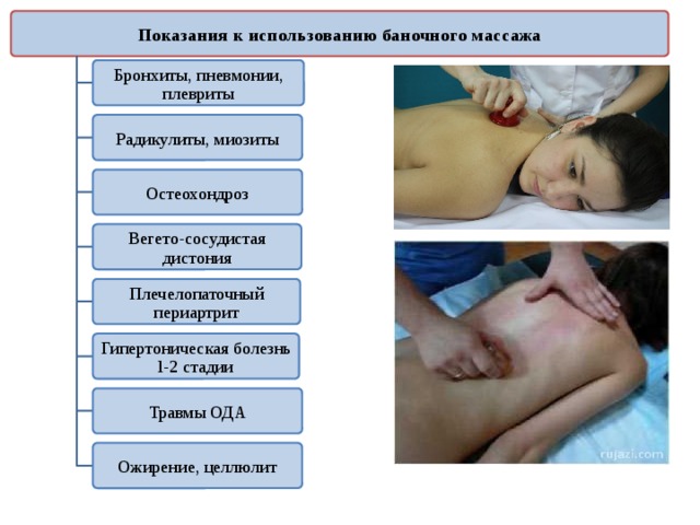 Показания к использованию баночного массажа Бронхиты, пневмонии, плевриты Радикулиты, миозиты Остеохондроз Вегето-сосудистая дистония Плечелопаточный периартрит Гипертоническая болезнь l-2 стадии Травмы ОДА Ожирение, целлюлит 