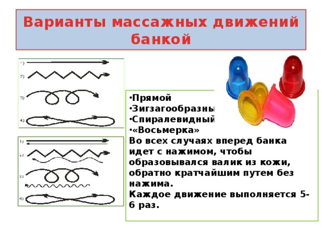 Баночный массаж схема движения банок