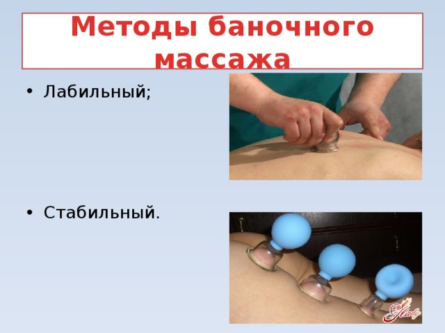 Методы баночного массажа Лабильный; Стабильный. 