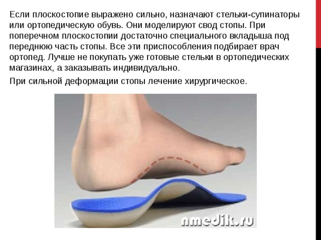 Ортопедические стельки при плоскостопии степени. Презентация на тему плоскостопие. Стельки при поперечном плоскостопии. Супинатор под свод стопы