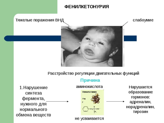 Фенилкетонурия генотип. Фенилкетонурия патогенез. Фенилпировиноградная олигофрения.