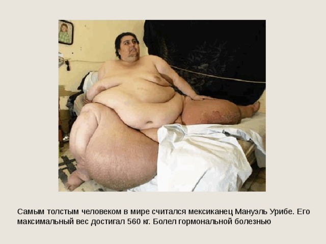 Самым толстым человеком в мире считался мексиканец Мануэль Урибе. Его максимальный вес достигал 560 кг. Болел гормональной болезнью 