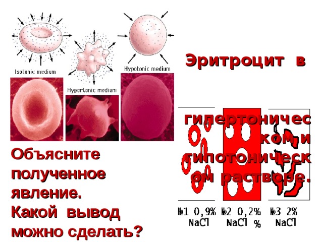  Эритроцит в гипертоническом и гипотоническом растворе.    Объясните полученное явление.  Какой вывод можно сделать?   