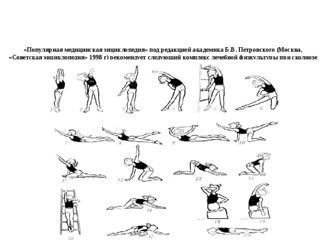 Лфк при сколиозе 1 степени у детей упражнения в картинках с описанием