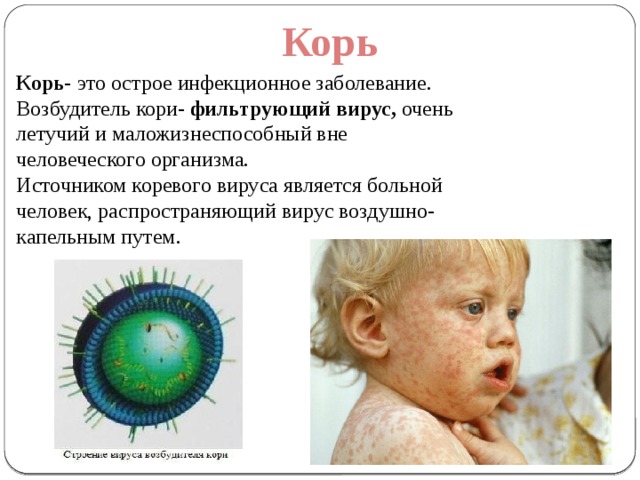 Детские инфекционные заболевания презентация