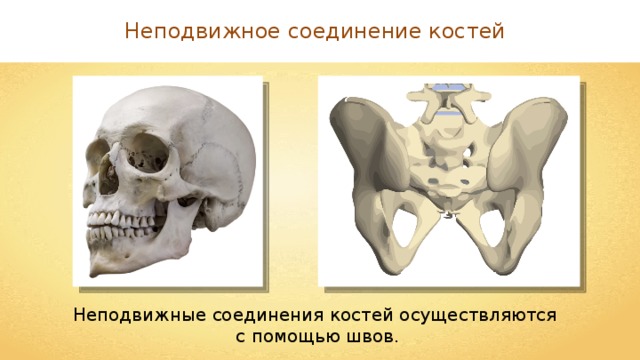Неподвижное соединение костей Неподвижные соединения костей осуществляются с помощью швов. 