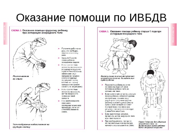 Подавился ребенок карта вызова