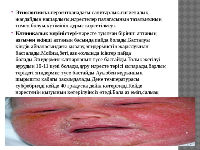 Этиологиясы -перзентханадағы санитарлық-гигиеналық жағдайдың нашарлығы,нәрестелер палатасының тазалығының төмен болуы,күтімінің дұрыс көрсетілмеуі. Клиникалық көріністері- нәресте туылған бірінші аптаның аяғымен екінші аптаның басында пайда болады.Басталуы кіндік айналасындағы қызару,эпидермистің жарылуынан басталады.Мойны,беті,аяқ-қолында ісіктер пайда болады.Эпидермис қатпарланып түсе бастайды.Толық жетілуі аурудың 10-11 күні болады,ауру нәресте терісі қызарады,барлық терідегі эпидермис түсе бастайды.Ауызбен мұрынның шырышты қабаты зақымдалады.Дене температурасы субфебрилді кейде 40 градусқа дейін көтеріледі.Кейде нәрестенің қызуының көтерілуінсіз өтеді.Бала аз еміп,салмақ жоғалтады.Лейкоцитарлы формуланың солға жылжуы байқалады.Гипохромды анемия тез арада дамиды. 