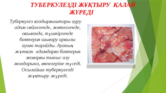ТУБЕРКУЛЕЗДІ ЖҰҚТЫРУ ҚАЛАЙ ЖҮРЕДІ ? Туберкулез қоздырғыштары ауру адам сөйлегенде, жөтелгенде, оқығанда, түшкіргенде бактерия шығару арқылы ауаға тарайды. Ауаның жұтқан адамдарға бактерия жоғарғы тыныс алу жолдарына, өкпелеріне түседі. Осылайша туберкулезді жұқтыру жүреді. 