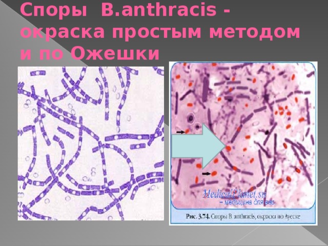 Споры B.anthracis - окраска простым методом и по Ожешки  