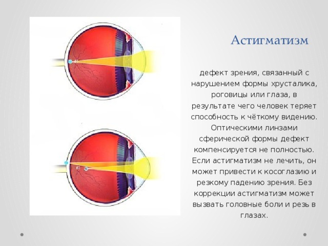 Дефект зрения презентация