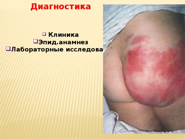 Диагностика    Клиника Эпид.анамнез Лабораторные исследования 