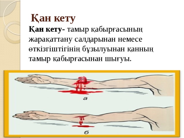 Презентация қан кету