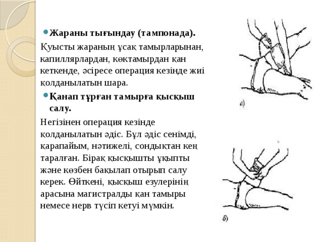 Жараны тығындау (тампонада). Қуысты жараның ұсақ тамырларынан, капиллярлардан, көктамырдан қан кеткенде, әсіресе операция кезінде жиі қолданылатын шара. Қанап тұрған тамырға қысқыш салу. Негізінен операция кезінде қолданылатын әдіс. Бұл әдіс сенімді, қарапайым, нәтижелі, сондықтан кең таралған. Бірақ қысқышты ұқыпты және көзбен бақылап отырып салу керек. Өйткені, қысқыш езулерінің арасына магистралды қан тамыры немесе нерв түсіп кетуі мүмкін. 