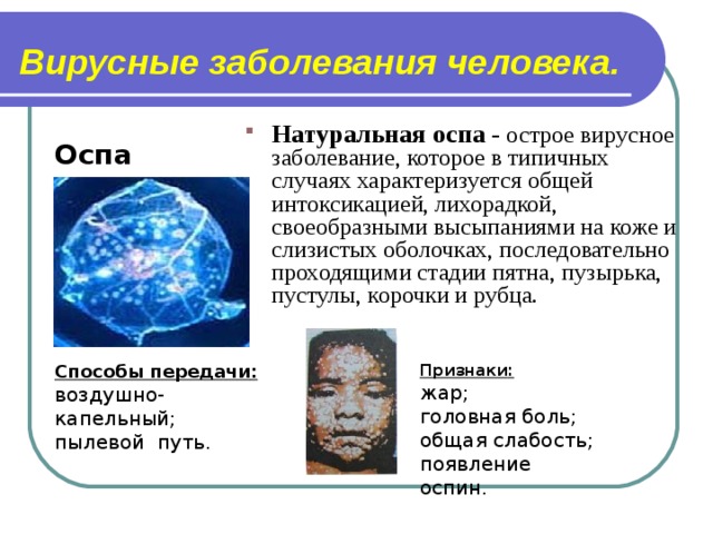 Вирусные заболевания человека. Натуральная оспа - острое вирусное заболевание, которое в типичных случаях характеризуется общей интоксикацией, лихорадкой, своеобразными высыпаниями на коже и слизистых оболочках, последовательно проходящими стадии пятна, пузырька, пустулы, корочки и рубца. Оспа Признаки : Способы передачи : воздушно-капельный; пылевой путь. жар; головная боль; общая слабость; появление оспин.