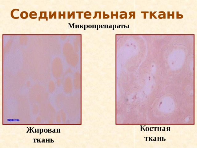 Соединительная ткань Микропрепараты Костная ткань Жировая ткань 