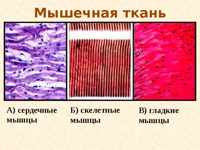 Мышечная ткань А) сердечные мышцы  Б) скелетные мышцы В) гладкие мышцы 