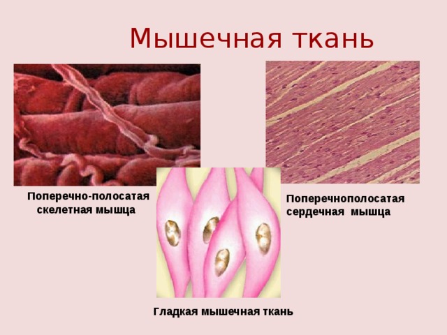 Мышечная ткань  Поперечно-полосатая  скелетная мышца Поперечнополосатая сердечная мышца Гладкая мышечная ткань 