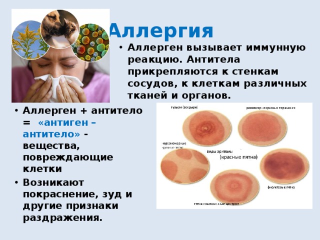 Аллергия Аллерген вызывает иммунную реакцию. Антитела прикрепляются к стенкам сосудов, к клеткам различных тканей и органов. Аллерген + антитело = «антиген – антитело» - вещества, повреждающие клетки Возникают покраснение, зуд и другие признаки раздражения. 