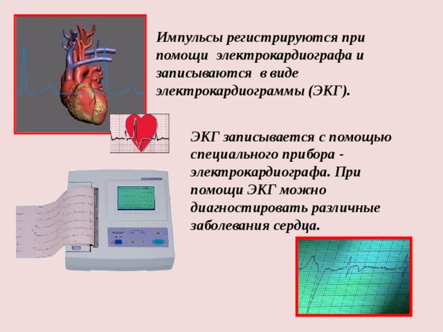 Импульсы регистрируются при помощи электрокардиографа и записываются в виде электрокардиограммы (ЭКГ). ЭКГ записывается с помощью специального прибора - электрокардиографа. При помощи ЭКГ можно диагностировать различные заболевания сердца. 