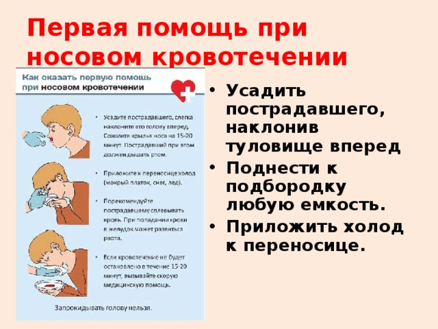 При носовом кровотечении выполняют. Правила оказания медицинской помощи при носовом кровотечении. Оказание первой помощи пострадавшему при кровотечении из носа. Оказание ПМП при носовом кровотечении. Первая помощь при носовом крово.