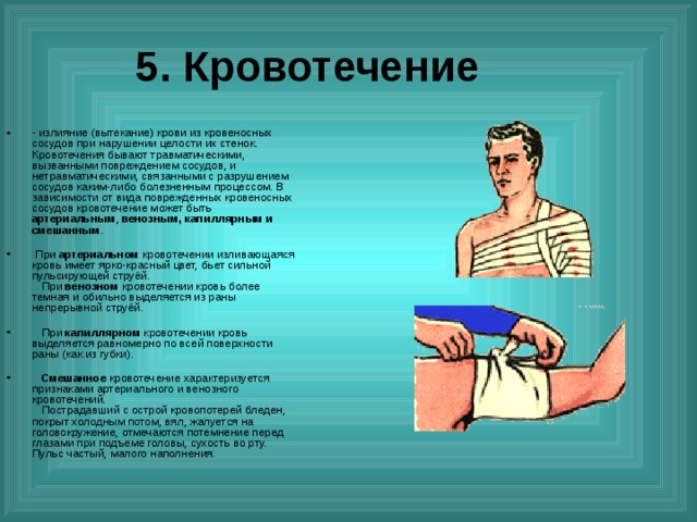 Кровотечения бывают. Признаки смешанного кровотечения. Опасность смешанного кровотечения. Нетравматическое кровотечение это. Опасность при смешанном кровотечении.