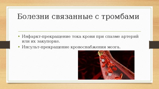 Болезни связанные с тромбами Инфаркт-прекращение тока крови при спазме артерий или их закупорке. Инсульт-прекращение кровоснабжения мозга. 