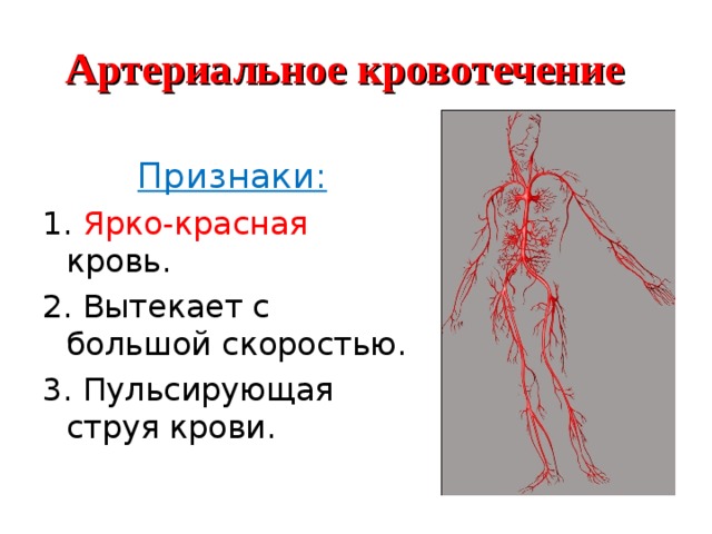 Артериальное кровотечение Признаки: 1. Ярко-красная кровь. 2. Вытекает с большой скоростью. 3. Пульсирующая струя крови. 