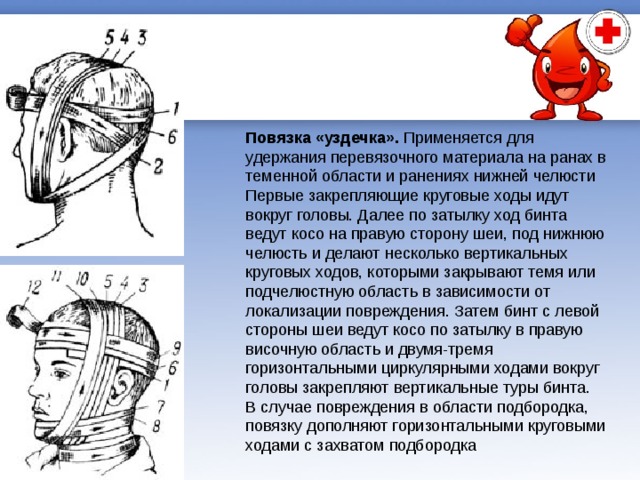 Повязки, общая характеристика и правила наложения