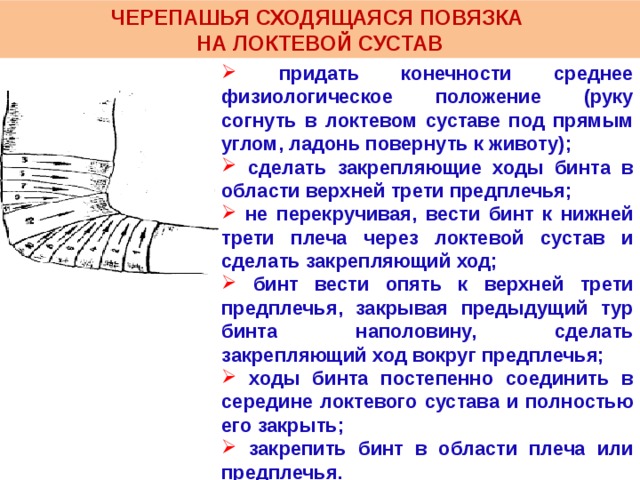 Наложение бинтовых повязок