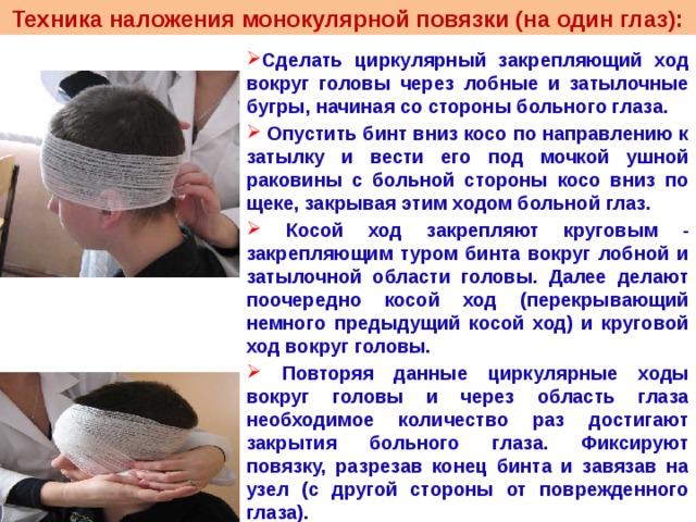 Наложение бинтовых повязок